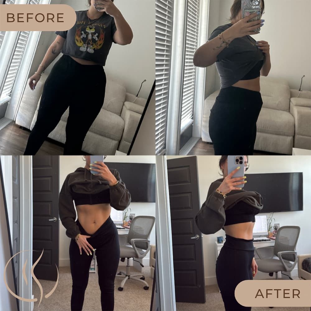 Before and after transformation photos showcasing progress.
