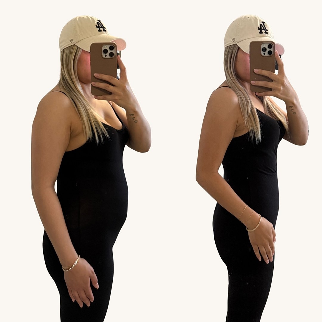 Medical Weight Loss Before & After