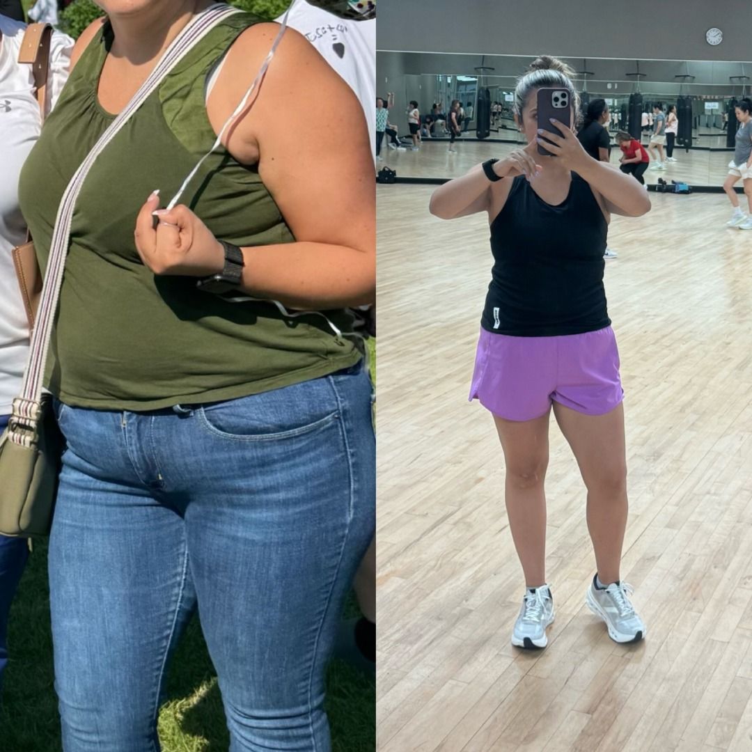 Medical Weight Loss Before & After